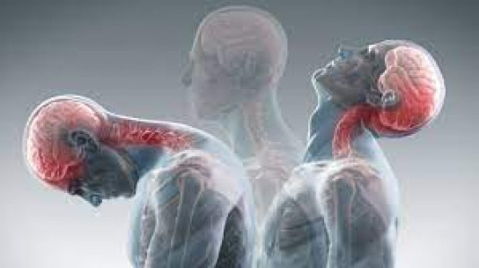 whiplash, choc, ostéopathie